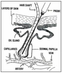 Electrolysis Hair Removal