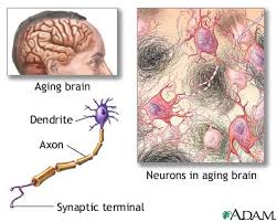 MD Consult: Alzheimer's - resources: Patient Education