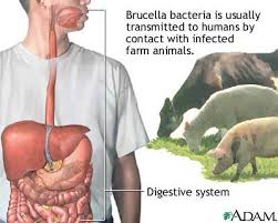 http://www.mdconsult.com/das/patient/body/0/0/10041/17102_en.jpg