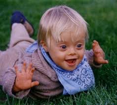 Down Syndrome births on the - via Daymix