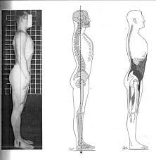 Lordotic Posture 2 on Flickr - via Daymix