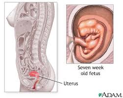  Abortion  -  elective  or