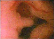      male penis from  female clitoris   