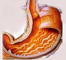 http://advancedhealing.files.wordpress.com/2008/12/gastritis.jpg