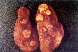 http://www.fao.org/docrep/003/t0756e/T0756E75.jpg
