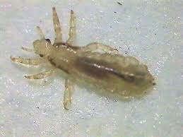 http://lancaster.unl.edu/enviro/HeadLice/Photo.htm