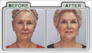 Hogs Haven: Face Lift Time? - via Daymix