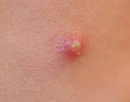 PLease help k thanks sexy tchs