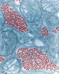 http://upload.wikimedia.org/wikipedia/commons/0/00/Eastern_equine_encephalitis.jpg