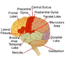 Broca x26s Aphasia