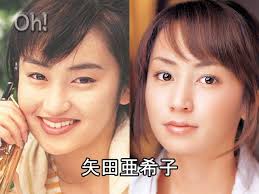芸能人って、整形
