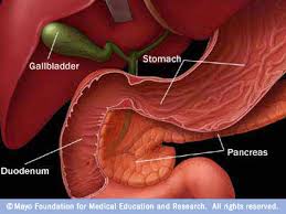 In  Zollinger-Ellison syndrome ,