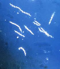 http://fr.academic.ru/pictures/frwiki/50/250px-Borrelia_burgdorferi-cropped.jpg