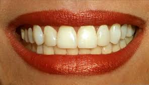  teeth  stem cells