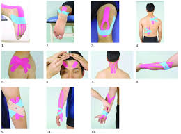 Kinesio� pu� essere utilizzato per: