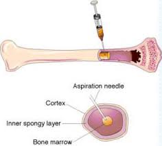 Bone Marrow