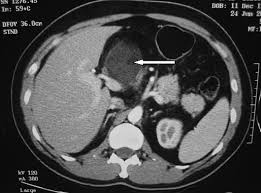 http://www.biij.org/2006/3/e20/fig1.jpg
