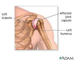 Shoulder joint inflammation - via Daymix