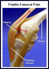 and " anterior knee pain "