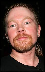 Image Axl Rose allegedly bites Picture