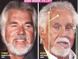 kenny-rogers-face-lift - via Daymix