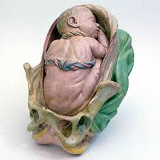 http://embryology.med.unsw.edu.au/history/images/1770breech2.jpg