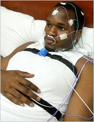   Narcolepsy    Symptoms  