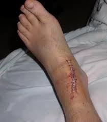 16 June The  staples   are out Phew 
