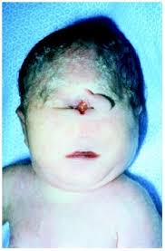 http://www.healthofchildren.com/images/gech_0001_0003_0_img0203.jpg