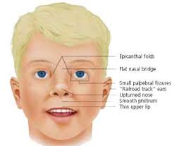 FAS facial features image modified