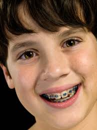 Child Wearing Braces