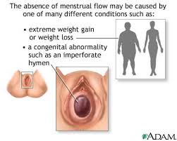  Secondary amenorrhea  occurs