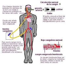   NEUROLOGIA   Ox geno en las venas 