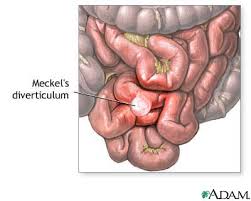 http://www.mdconsult.com/das/patient/body/0/0/10041/8766_en.jpg