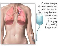 chemotherapy picture - via Daymix