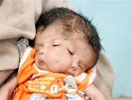 Baby Born with Two Faces