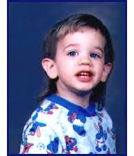 Fragile X Syndrome Poster