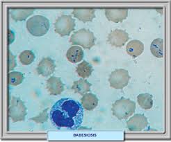 http://www.iqb.es/Hematologia/atlas/infecciones/babesiosis01.jpg