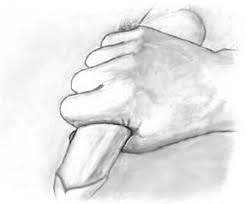In this common  technique  