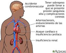 http://www.nlm.nih.gov/medlineplus/spanish/ency/images/ency/fullsize/19473.jpg