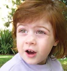   Asperger x26s   syndrome is also known as    
