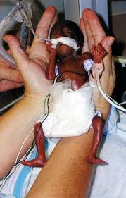 imagine how tiny a baby is