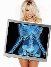   Pam Anderson   X Ray