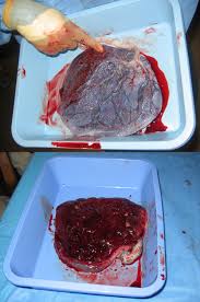 Placenta of a - via Daymix