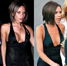 Did Posh get a boob reduction
