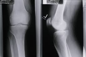 Radiography