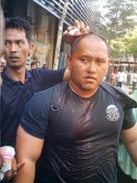 The grim pictures of blood soaked