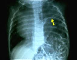 http://brachialplexus.wustl.edu/portuguese/images/xray.jpg