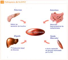 http://www.accu-chek.com.uy/images/causas_tipo2_1.gif
