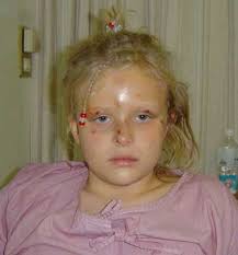 little girl's problem